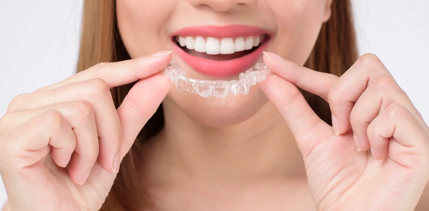 Clear Invisalign Aligner Treatment
