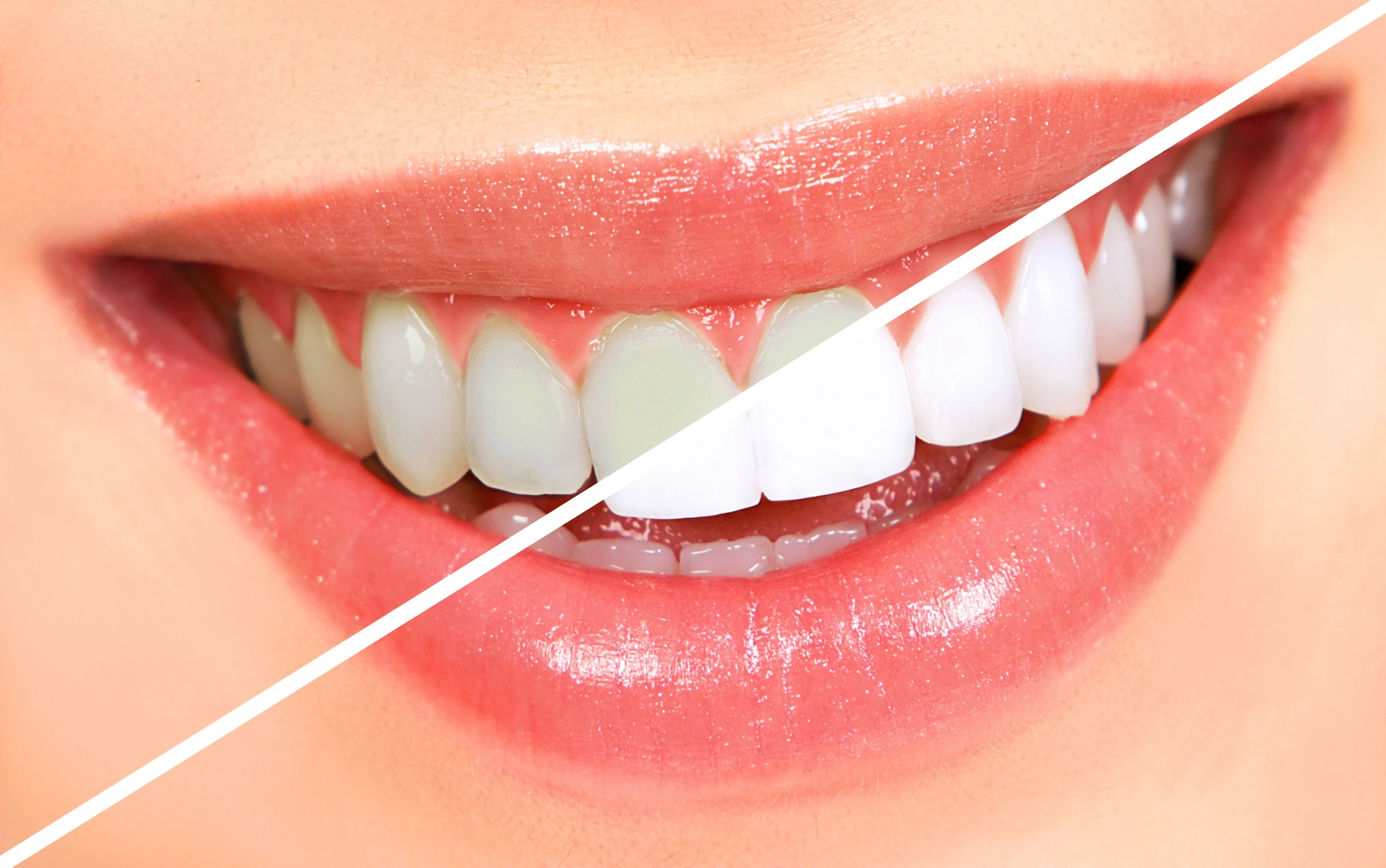 Close up of a beautiful healthy bright white smile in soft natural light